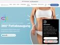 Alle werden nur noch Augen für Sie haben